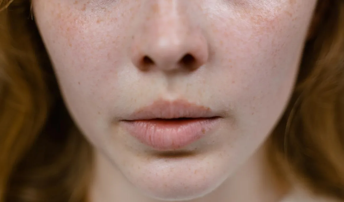 Czy wiotkość skóry może ustąpić samoistnie w ciągu 12 miesięcy?